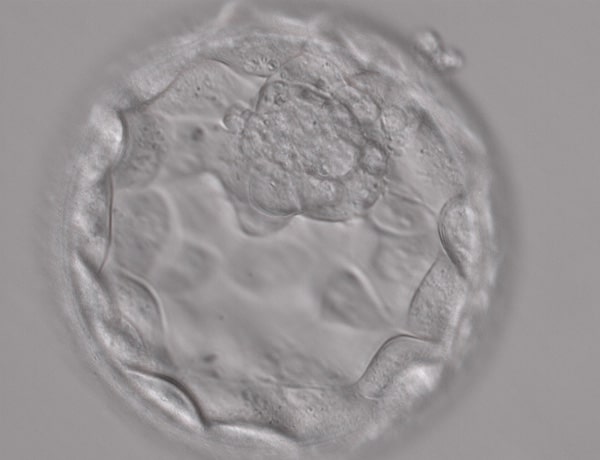 What advantages does a blastocyst culture have?