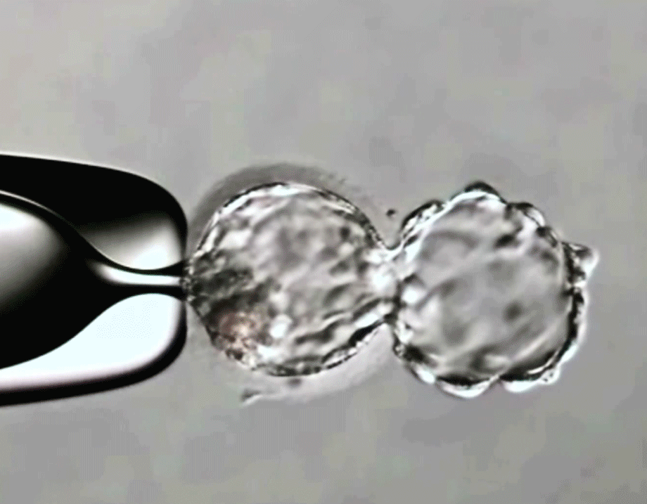 What is Preimplantation genetic diagnosis (PGD)?