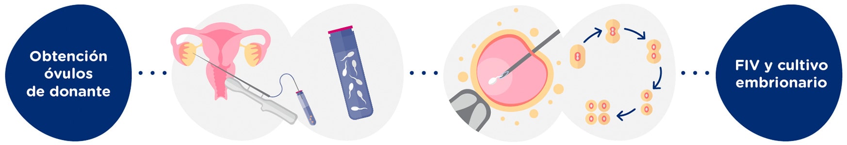 Obtención de óvulos de donante + muestra de semen<br>
Fecundación <i>in Vitro</i> + embriones en cultivo 5 días