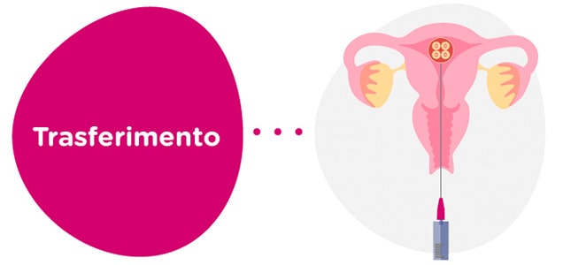 Trasferimento di embrioni