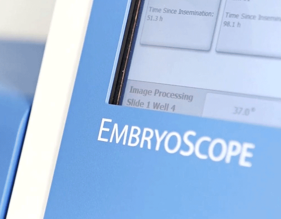 Cos’è l’ Embryoscope?