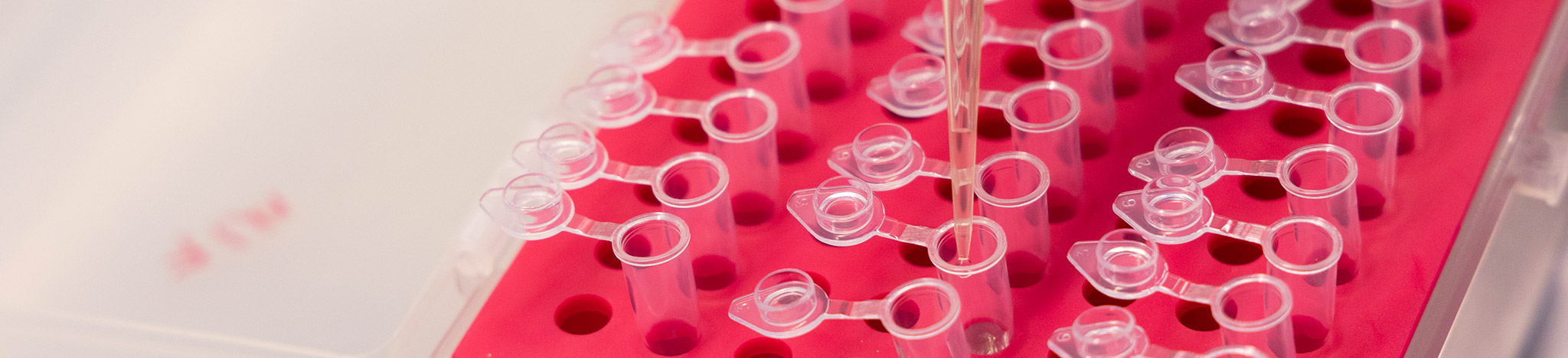 Sterilität beim Mann