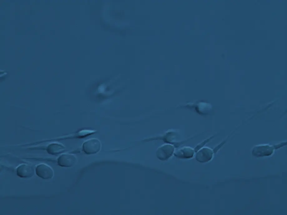 ¿Qué es FertileChip? 