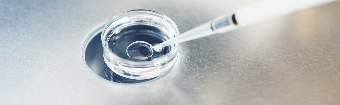 What is conventional fertilisation?