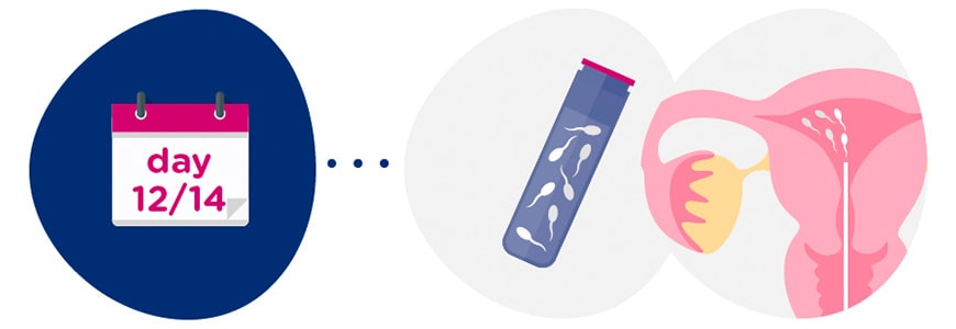 Sperm sample preparation + insemination