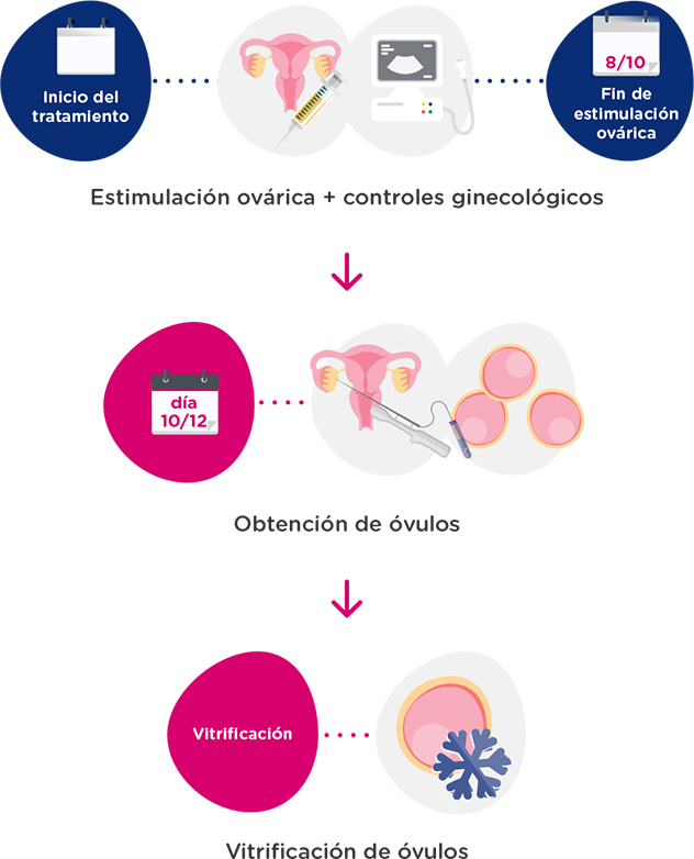 ¿En qué consiste la vitrificación de óvulos? ¿En qué consiste la vitrificación de óvulos?