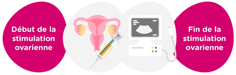 Stimulation ovarienne<br>
+ examens gynécologiques