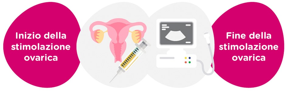 Stimolazione ovarica + controlli ginecologici