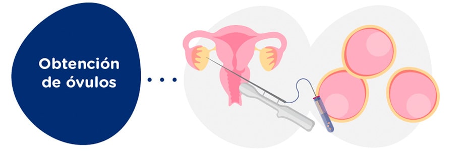 Obtención de óvulos