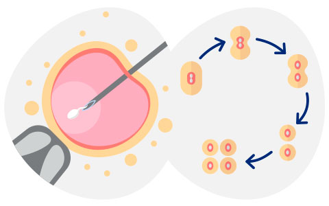 <i>In Vitro</i> fertilisation + embryo culture