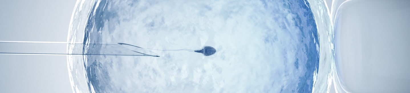 Comment réalise-t-on la méthode ROPA ?