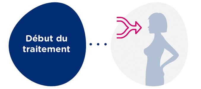 Synchronisation avec la donneuse