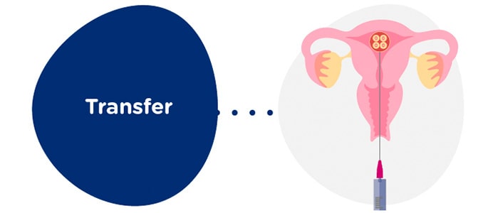Embryo transfer to the recipient