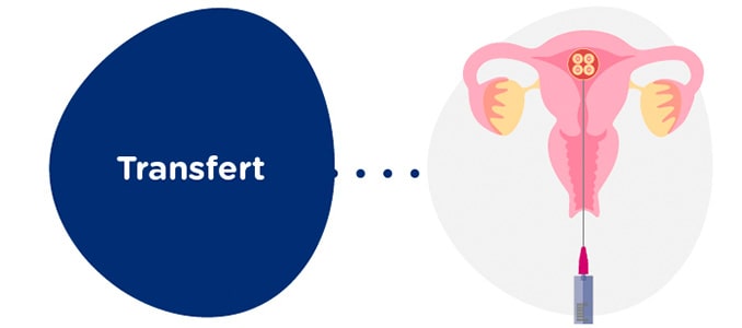 Transfert embryonnaire à la receveuse