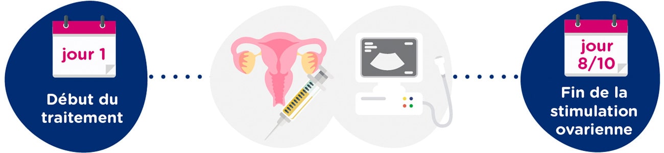 Stimulation ovarienne + examens gynécologiques