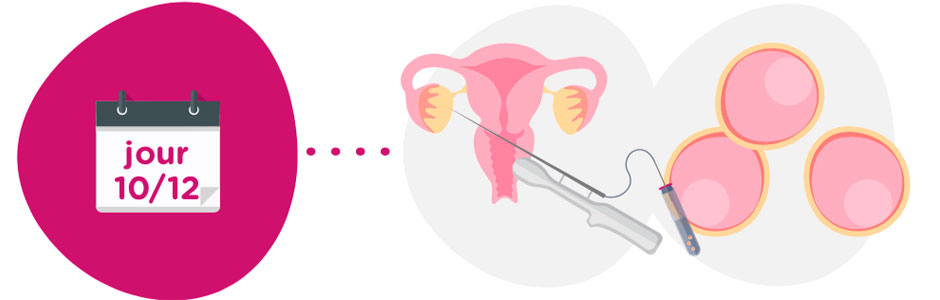 Recueil des ovocytes