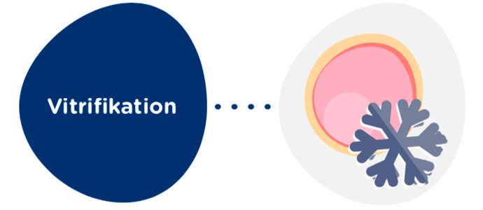 Vitrifikation der Eizellen