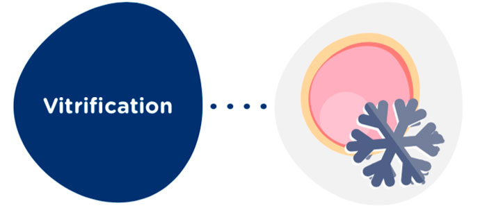 Egg vitrification