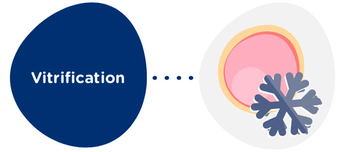 Vitrification des ovocytes