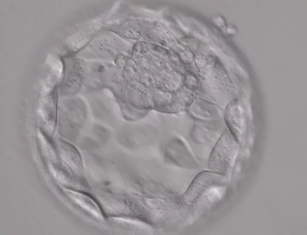 What advantages does a blastocyst culture have?