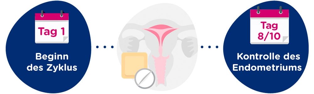 Vorbereitung des Endometriums