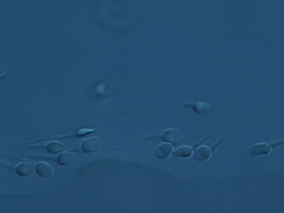 Què és FertileChip? 