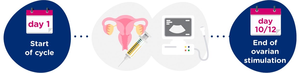 Ovarian stimulation + gynaecological tests