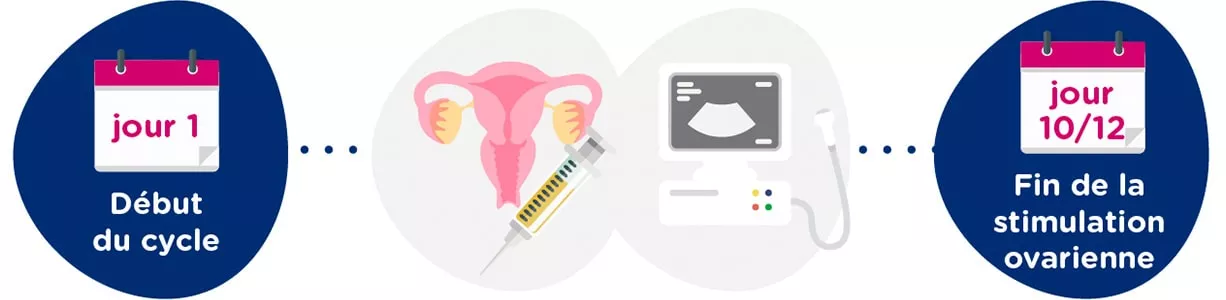 Stimulation ovarienne + examens gynécologiques