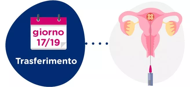 Trasferimento degli embrioni