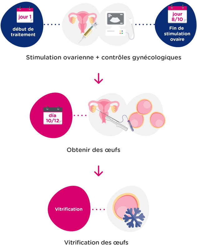 En quoi consiste la vitrification d’ovocytes?