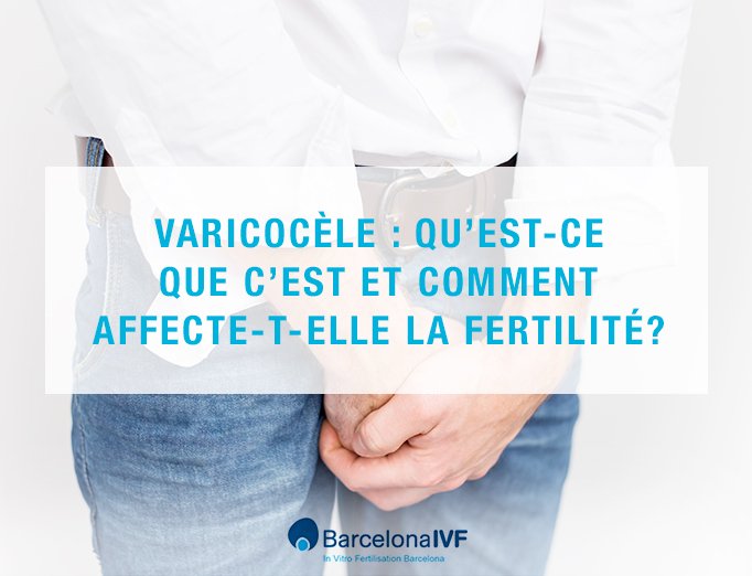 Varicocèle: comment affecte-t-elle la fertilité