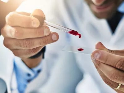La clé des hormones de la fertilité : FSH, LH, Progestérone et AMH
