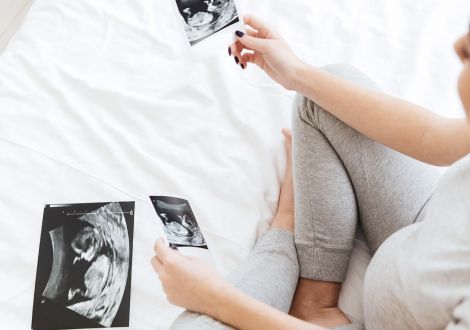 Riesgo de embarazo múltiple en reproducción asistida