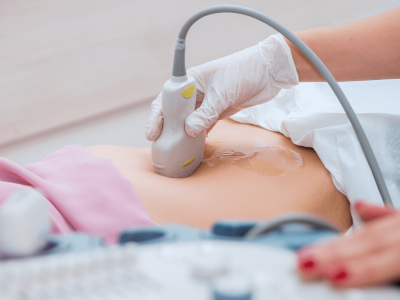 First ultrasound scan after IVF or egg donation