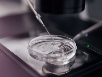 Embryoscope, what is it and what are its advantages?