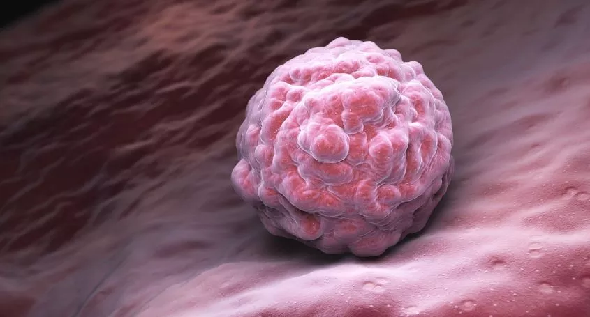 When does fertilisation occur after ovulation?