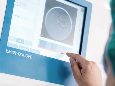 Embryoscope