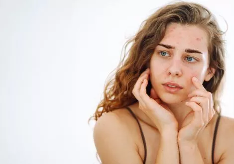 Hyperandrogenism and fertility: symptoms, causes and treatments