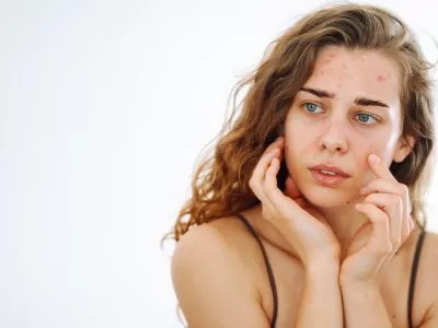 Hyperandrogenism and fertility: symptoms, causes and treatments