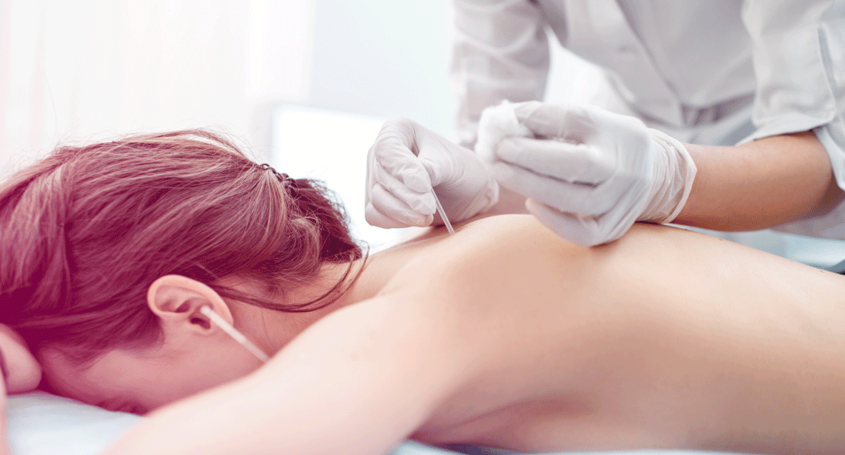 Acupuntura y fecundación in vitro (FIV)