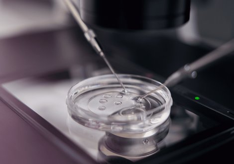 Embryoscope, che cos’è e che vantaggi ha?