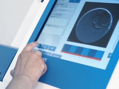 Embryoscope en Barcelona