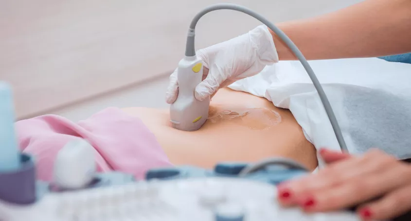 Première échographie après une FIV ou un don d'ovules
