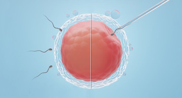 FIV convenzionale vs ICSI: quali sono le tecniche e come si differenziano?