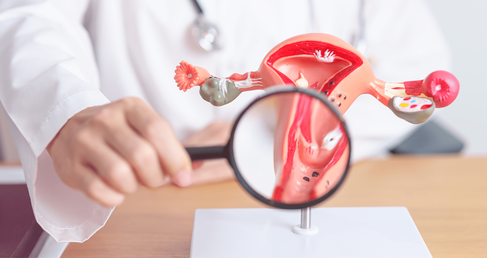 dolori basso ventre e perdite bianche liquide LEUCORREA, Le perdite bianche in gravidanza, per quanto siano un fenomeno  fisiologico, possono causare spesso fastidi o disagio come la sensazione di  avere le mutandine sempre bagnate: a volte può main image 0