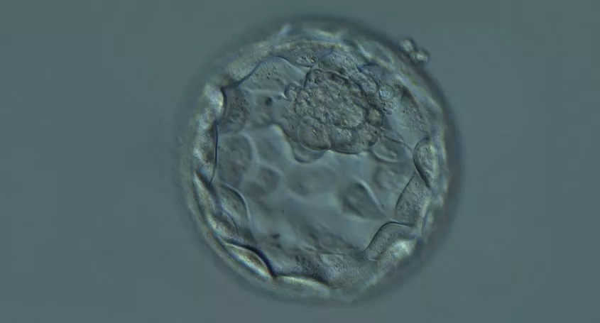 Perché l'impianto di una blastocisti euploide fallisce?