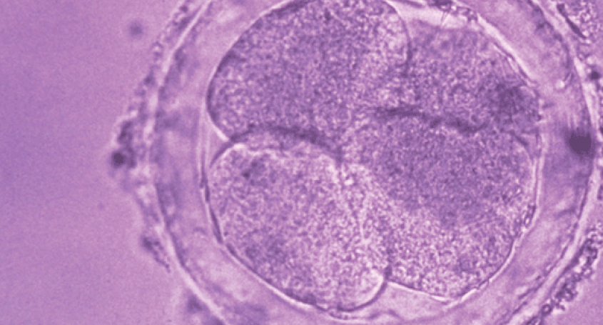 Egg Donation, the solution for problems related to oocytes