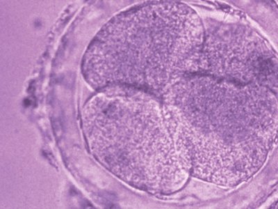 Egg Donation, the solution for problems related to oocytes