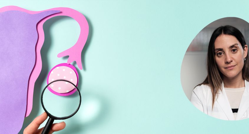 PCOS verstehen: Herausforderungen und Lösungen für die Fruchtbarkeit