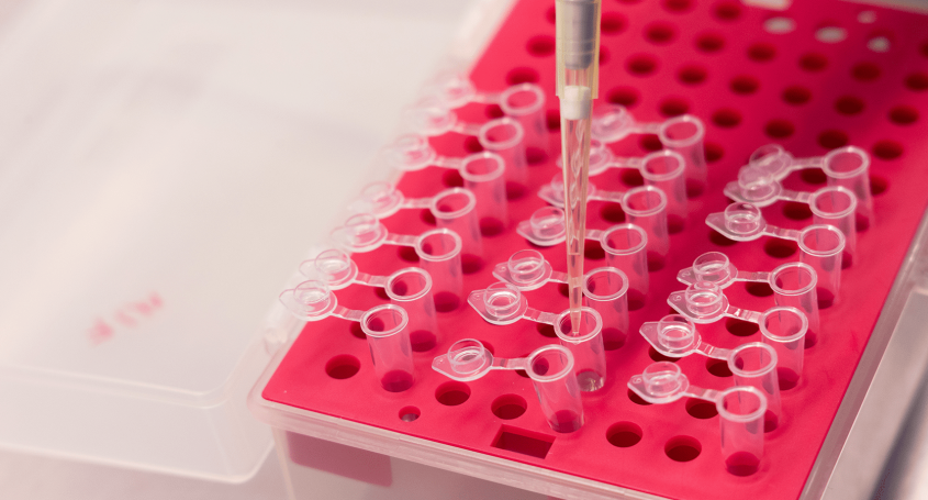Per a què serveix una biòpsia d'endometri?